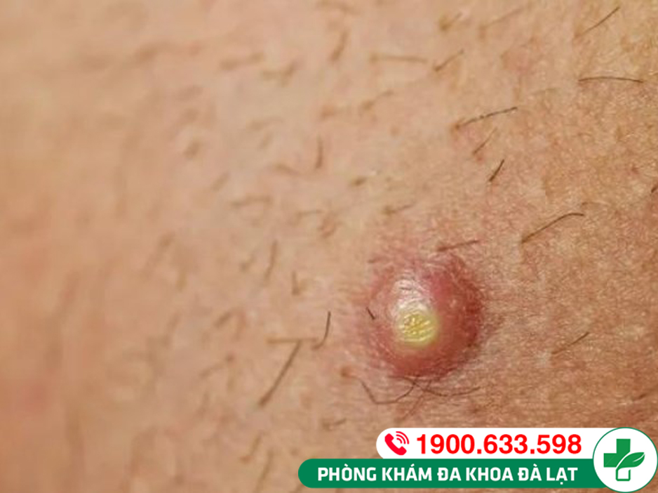 Hình ảnh minh họa